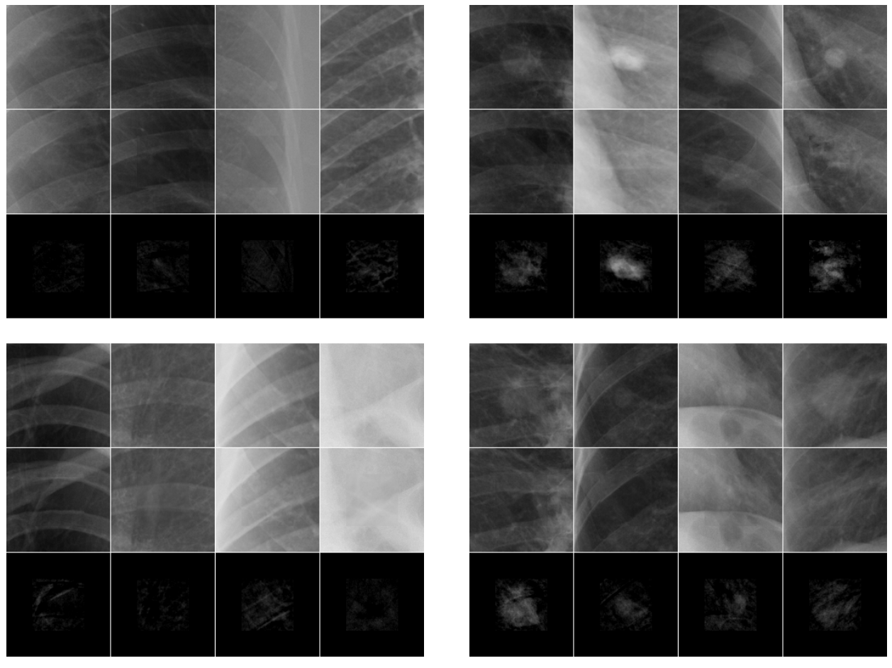 Context Encoding Chest X-rays