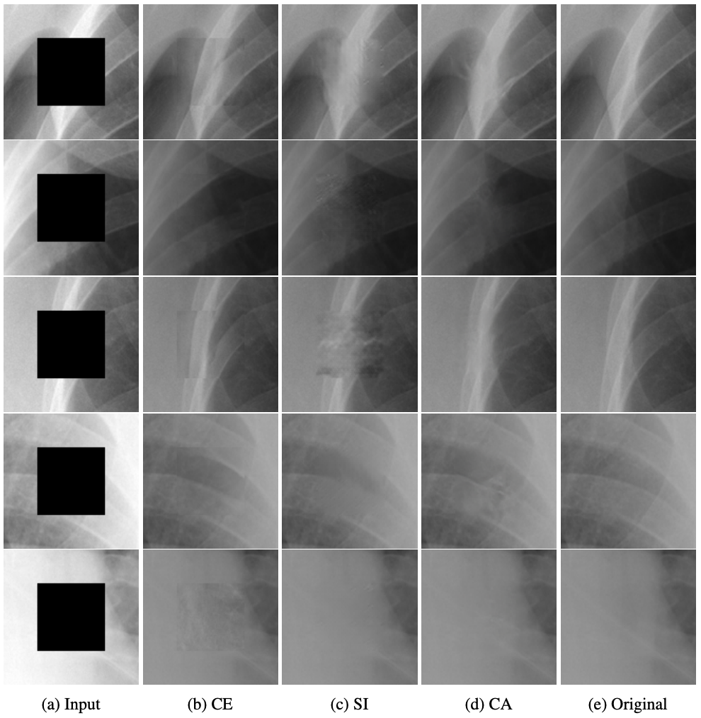 Chest X-ray Inpainting